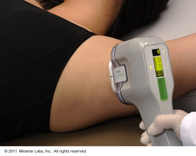 miraDry Hyperhidrosis UK